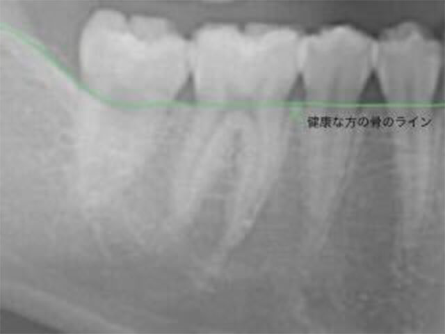 健康な状態